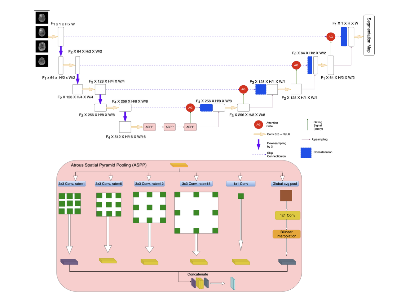 Hybridization of Attention UNet...